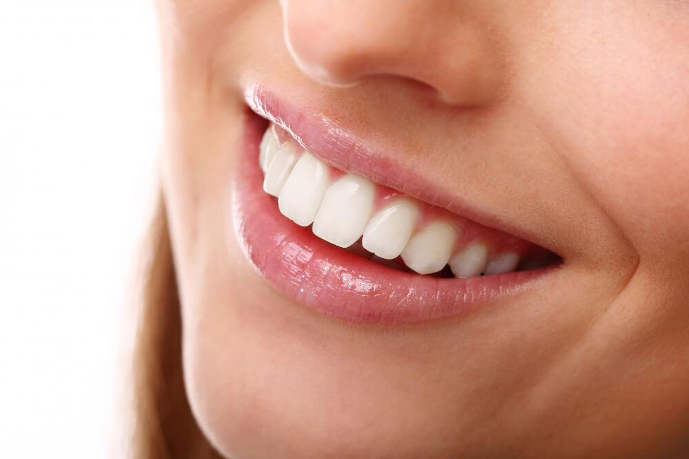 Close-up of a patient's bright, healthy smile after treatment at Al Care Dental